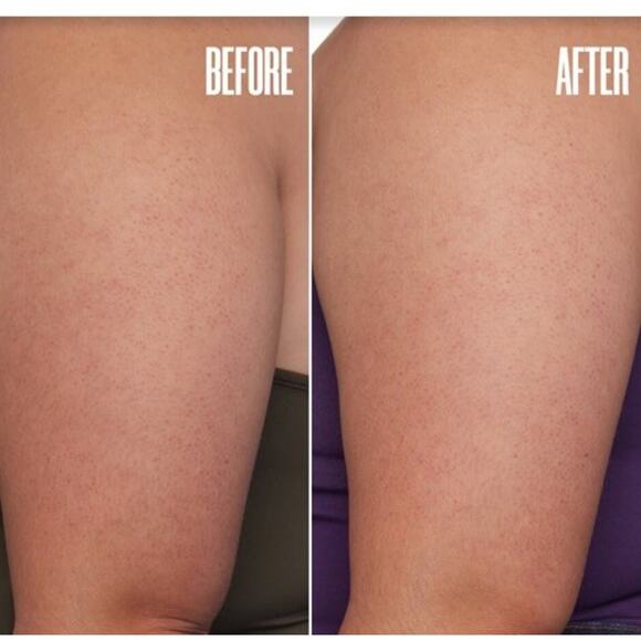 Maelys Get Level Keratosis Pilaris Body Scrub 5.0 FL. oz. - Picture 2 of 6